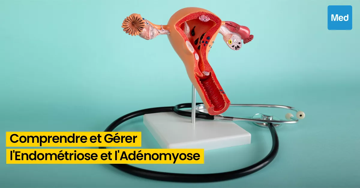 Endométriose et Adénomyose : Comprendre et Gérer Ces Affections Gynécologiques